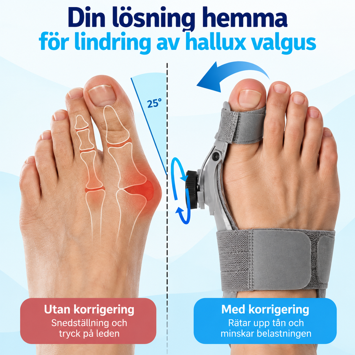 OrtoWell™ Tåstöd - Naturlig smärtlindring för trötta, ömma fötter